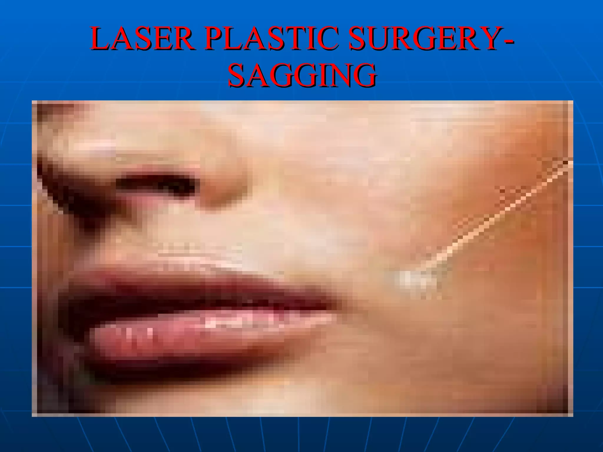LASER PLASTIC SURGERY-SAGGING 