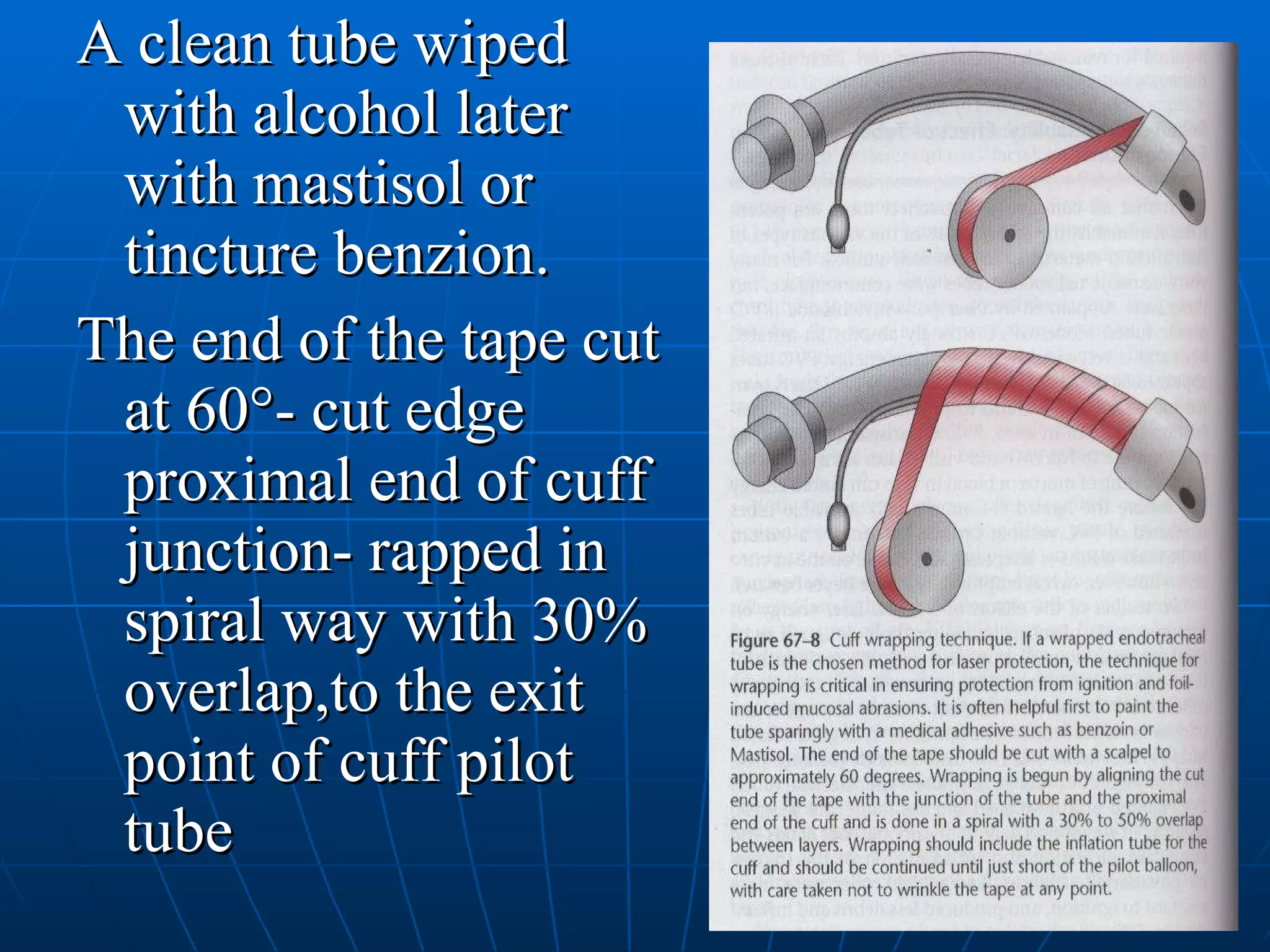 A clean tube wiped with alcohol later with mastisol or tincture benzion. The end of the tape cut at 60°- cut edge proximal end of cuff junction- rapped in spiral way with 30% overlap,to the exit point of cuff pilot tube  