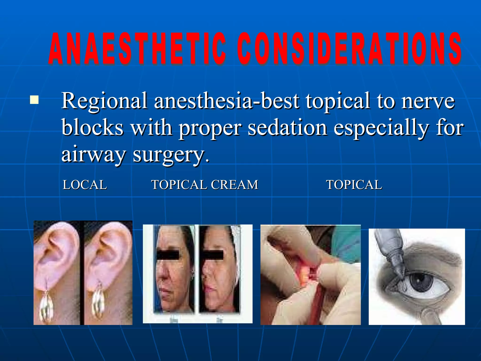 Regional anesthesia-best topical to nerve blocks with proper sedation especially for airway surgery . LOCAL  TOPICAL CREAM  TOPICAL ANAESTHETIC CONSIDERATIONS 