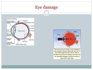 Eye damage
 