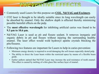 • Commonly used Lasers for this purpose are CO2, Nd:YAG and Excimers.
• CO2 laser is thought to be ideally suitable since its long wavelength can easily
be absorbed by enamel. Only the shallow depth is affected thereby minimizing
possible harmful effects on the pulp.
• The most effective wavelength for inhibiting artificial caries was found to be
9.3 μm to 10.6 μm.
• Nd:YAG Laser is used as pit and fissure sealant. It removes inorganic and
organic debris in pit and fissure without injuring the surrounding healthy
enamel. The laser effect would weld hydroxyl apatite crystals blocking the
pits/fissures.
• Following two features are important for Lasers to help in caries prevention:
• Minimum energy density is required to avoid damaging the soft tissues especially dental pulp.
• The ability to direct the Laser beam within the restricted space by means of a flexible beam
guide.
• Earlier authors opined that Nd:YAG Laser may increase the acid resistance of tooth enamel.
This effect is caused by melting of a thin glaze like surface layer of enamel.
LASERS AND ITS APPLICATION IN CONSERVATIVE AND ENDODONTIC DENTISTRY 42
 