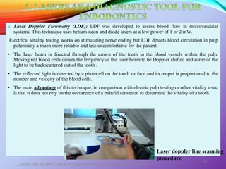 a. Laser Doppler Flowmetry (LDF): LDF was developed to assess blood flow in microvascular
systems. This technique uses helium-neon and diode lasers at a low power of 1 or 2 mW.
Electrical vitality testing works on stimulating nerve ending but LDF detects blood circulation in pulp
potentially a much more reliable and less uncomfortable for the patient.
• The laser beam is directed through the crown of the tooth to the blood vessels within the pulp.
Moving red blood cells causes the frequency of the laser beam to be Doppler shifted and some of the
light to be backscattered out of the tooth .
• The reflected light is detected by a photocell on the tooth surface and its output is proportional to the
number and velocity of the blood cells.
• The main advantage of this technique, in comparison with electric pulp testing or other vitality tests,
is that it does not rely on the occurrence of a painful sensation to determine the vitality of a tooth.
• .
LASERS AND ITS APPLICATION IN CONSERVATIVE AND ENDODONTIC DENTISTRY
55
Laser doppler line scanning
procedure
 