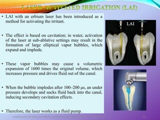 • LAI with an erbium laser has been introduced as a
method for activating the irritant.
• The effect is based on cavitation; in water, activation
of the laser at sub-ablative settings may result in the
formation of large elliptical vapor bubbles, which
expand and implode.
• These vapor bubbles may cause a volumetric
expansion of 1600 times the original volume, which
increases pressure and drives fluid out of the canal.
• When the bubble implodes after 100–200 μs, an under
pressure develops and sucks fluid back into the canal,
inducing secondary cavitation effects.
• Therefore, the laser works as a fluid pump.
LASERS AND ITS APPLICATION IN CONSERVATIVE AND ENDODONTIC DENTISTRY 62
 