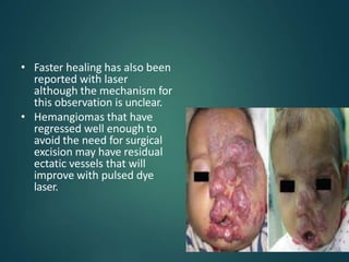 • Faster healing has also been
reported with laser
although the mechanism for
this observation is unclear.
• Hemangiomas that have
regressed well enough to
avoid the need for surgical
excision may have residual
ectatic vessels that will
improve with pulsed dye
laser.
 