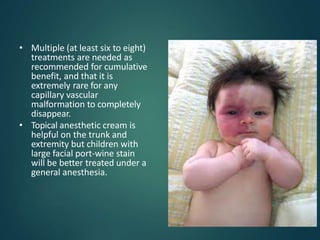 • Multiple (at least six to eight)
treatments are needed as
recommended for cumulative
benefit, and that it is
extremely rare for any
capillary vascular
malformation to completely
disappear.
• Topical anesthetic cream is
helpful on the trunk and
extremity but children with
large facial port-wine stain
will be better treated under a
general anesthesia.
 