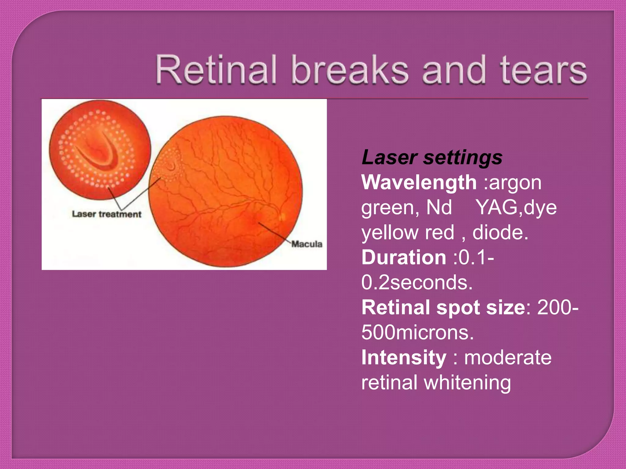 Laser settings
Wavelength :argon
green, Nd YAG,dye
yellow red , diode.
Duration :0.1-
0.2seconds.
Retinal spot size: 200-
500microns.
Intensity : moderate
retinal whitening
 