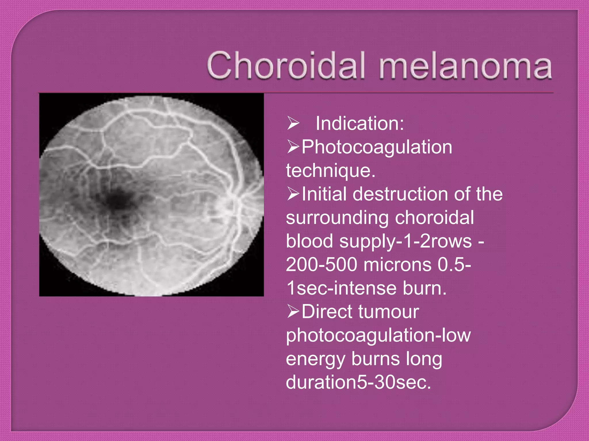  Indication:
Photocoagulation
technique.
Initial destruction of the
surrounding choroidal
blood supply-1-2rows -
200-500 microns 0.5-
1sec-intense burn.
Direct tumour
photocoagulation-low
energy burns long
duration5-30sec.
 