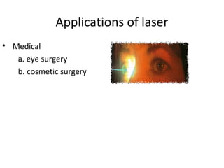 Applications of laser
• Medical
a. eye surgery
b. cosmetic surgery
 