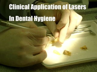 Clinical Application of Lasers In Dental Hygiene 