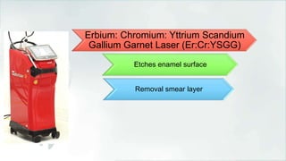 Erbium: Chromium: Yttrium Scandium
Gallium Garnet Laser (Er:Cr:YSGG)
Etches enamel surface
Removal smear layer
 