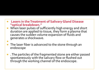  Lasers in theTreatment of Salivary Gland Disease
“optical breakdown.”
 When laser pulses of sufficiently high energy and short
duration are applied to tissue, they form a plasma that
causes the sudden volume expansion of fluids and
generates a shockwave.

 The laser fiber is advanced to the stone through an
endoscope
 .The particles of the fragmented stone are either passed
spontaneously with the salivary flow or flushed out
through the working channel of the endoscope.
 
