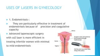 USES OF LASERS IN GYNECOLOGY
 1. Endometriosis-:
 They are particularly effective in treatment of
endometriosis because of precision and coagulative
capacity
 Advanced laporoscopic surgery
with co2 laser is more efficient in
treating infertile women with minimal
to mild endometriosis
 