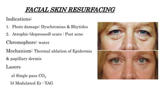 FACIAL SKIN RESURFACING
Indications:
1. Photo damage: Dyschromias & Rhytides
2. Atrophic (depressed) scars : Post acne
Chromophore: water
Mechanism: Thermal ablation of Epidermis
& papillary dermis
Lasers
a) Single pass CO2
b) Modulated Er : YAG
 