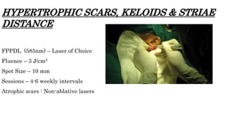 HYPERTROPHIC SCARS, KELOIDS & STRIAE
DISTANCE
FPPDL (585nm) – Laser of Choice
Fluence – 3 J/cm2
Spot Size – 10 mm
Sessions – 4-6 weekly intervals
Atrophic scars : Non-ablative lasers
 