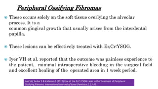 Peripheral Ossifying Fibromas
 These occurs solely on the soft tissue overlying the alveolar
process. It is a
common gingival growth that usually arises from the interdental
papilla.
 These lesions can be effectively treated with Er,Cr:YSGG.
 Iyer VH et al. reported that the outcome was painless experience to
the patient, minimal intraoperative bleeding in the surgical field
and excellent healing of the operated area in 1 week period.
Iyer VH, Sarkar S & Kailasam S (2012) Use of the Er,Cr:YSGG Laser in the Treatment of Peripheral
Ossifying Fibroma. International Jour-nal of Laser Dentistry 2, 51-55.
 