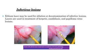Infectious lesions
 Erbium laser may be used for ablation or decontamination of infective lesions.
Lasers are used in treatment of herpetic, candidiasis, and papilloma virus
lesions.
Gaeta GM (2013) laser treatment in medicine and oral pathology.
Http://www.Giovannimariagaeta.It/laser %20book%202010.Pdf
 
