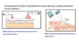 Effect of distance of laser beam on the spot-size at
target tissue surface Effect of focused and defocused laser beam on
target tissue
Focused beam results in well-defined incision whereas a defocused beam
causes ablation.
 