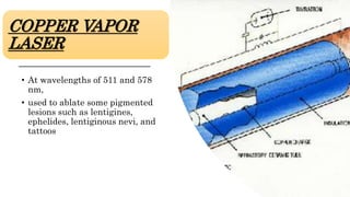 COPPER VAPOR
LASER
• At wavelengths of 511 and 578
nm,
• used to ablate some pigmented
lesions such as lentigines,
ephelides, lentiginous nevi, and
tattoos
 
