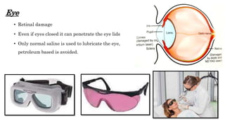 Eye
• Retinal damage
• Even if eyes closed it can penetrate the eye lids
• Only normal saline is used to lubricate the eye,
petroleum based is avoided.
 