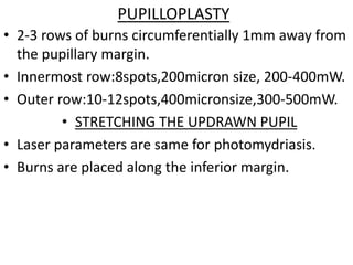PUPILLOPLASTY
• 2-3 rows of burns circumferentially 1mm away from
the pupillary margin.
• Innermost row:8spots,200micron size, 200-400mW.
• Outer row:10-12spots,400micronsize,300-500mW.
• STRETCHING THE UPDRAWN PUPIL
• Laser parameters are same for photomydriasis.
• Burns are placed along the inferior margin.
 