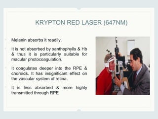 • Melanin absorbs it readily.
• It is not absorbed by xanthophylls & Hb
& thus it is particularly suitable for
macular photocoagulation.
• It coagulates deeper into the RPE &
choroids. It has insignificant effect on
the vascular system of retina.
• It is less absorbed & more highly
transmitted through RPE
KRYPTON RED LASER (647NM)
 