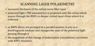 SCANNING LASER POLARIMETRY
• measures thickness of the retinal nerve fibre layer
• polarised light (780 nanometres) is projected onto the retina which
passes through the RNFL to deeper retinal layers from where it is
reflected
• as RNFL fibres are arranged in a parallel manner, it acts as a
birefringerent medium and changes the state of the polarised light
passing through it
• the magnitude of this change of polarisation (retardation) correlates
with RNFL thickness
 