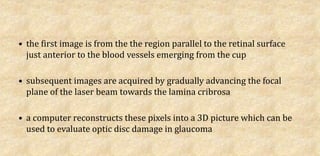 • the first image is from the the region parallel to the retinal surface
just anterior to the blood vessels emerging from the cup
• subsequent images are acquired by gradually advancing the focal
plane of the laser beam towards the lamina cribrosa
• a computer reconstructs these pixels into a 3D picture which can be
used to evaluate optic disc damage in glaucoma
 