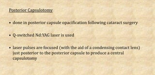 Posterior Capsulotomy
• done in posterior capsule opacification following cataract surgery
• Q-switched Nd:YAG laser is used
• laser pulses are focused (with the aid of a condensing contact lens)
just posterior to the posterior capsule to produce a central
capsulotomy
 