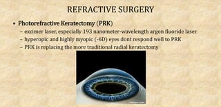 REFRACTIVE SURGERY
• Photorefractive Keratectomy (PRK)
– excimer laser, especially 193 nanometer-wavelength argon fluoride laser
– hyperopic and highly myopic (-6D) eyes dont respond well to PRK
– PRK is replacing the more traditional radial keratectomy
 