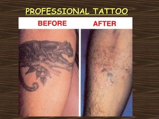 PROFESSIONAL TATTOO
 