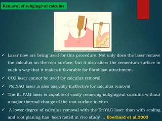 Lasers in periodontics | PPTX