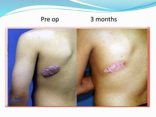 Pre op 3 months
 