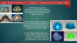  This technique uses the
combination of the CAD/CAM and
LRF (Laser Rapid Forming) methods
for forming the titanium plate of a
complete denture.
Laser scanner, reverse engineering
software, and standard triangulation
language (STL) formatted denture
base plate and sliced into a sequence
of numerical controlled codes.
 The denture plate will be built
layer-by-layer, on the LRF system.
After the traditional finishing
techniques, this denture plate will
be acceptable for use in patients.
Laser Rapid Forming of A Complete Titanium Denture Base Plate:
 