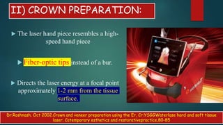 II) CROWN PREPARATION:
 The laser hand piece resembles a high-
speed hand piece
 Fiber-optic tips instead of a bur.
 Directs the laser energy at a focal point
approximately 1-2 mm from the tissue
surface.
Dr.Roshnash. Oct 2002.Crown and veneer preparation using the Er, Cr:YSGGWaterlase hard and soft tissue
laser. Cotemporary esthetics and restorativepractice,80-85
 