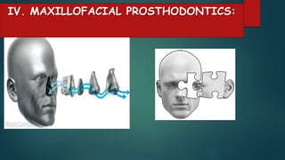 IV. MAXILLOFACIAL PROSTHODONTICS:
 