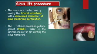 Sinus lift procedure
• The procedure can be done by
making the lateral osteotomy
with a decreased incidence of
sinus membrane perforation.
• The yttrium-scandium-gallium-
garnet (YSGG) laser is the
optimal choice for not cutting the
sinus membrane
 