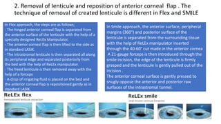 2. Removal of Ienticule and reposition of anterior corneal flap . The
technique of removal of created lenticule is different in Flex and SMILE
In Flex approach, the steps are as follows;
- The hinged anterior corneal flap is separated from
the anterior surface of the lenticule with the help of a
specially designed ReLEx Manipulator.
- The anterior corneal flap is then lifted to the side as
in standard LASIK.
- The intrastromal lenticule is then separated all along
its peripheral edge and separated posteriorly from
the bed with the help of ReLEx manipulator.
- The freed lenticule is then removed away with the
help of a forceps
- A drop of irrigating fluid is placed on the bed and
the anterior corneal flap is repositioned gently as in
standard LASIK.
In Smile approach, the anterior surface, peripheral
margins (360°) and posterior surface of the
lenticule is separated from the surrounding tissue
with the help of ReLEx manipulator inserted
through the 40-60° cut made in the anterior cornea
A 21-gauge forceps is then introduced through the
smile incision, the edge of the lenticule is firmly
grasped and the lenticule is gently pulled out of the
incision .
The anterior corneal surface is gently pressed to
snugly oppose the anterior and posterior raw
surfaces of the intrastromal tunnel.
 