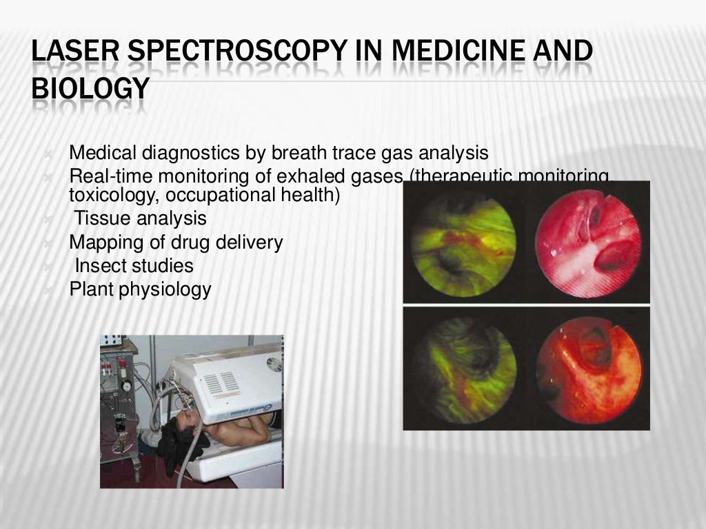 Laser spectroscopy