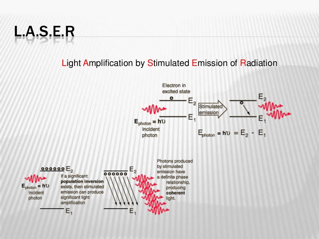 Laser spectroscopy