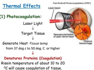 Thermal Effects
(1) Photocoagulation:
Laser Light

Target Tissue

Generate Heat -Tissue temp.:increases
from 37 deg c to 50 deg. C or higher

Denatures Proteins (Coagulation)
Risein temperature of about 10 to 20
0C will cause coagulation of tissue.
 