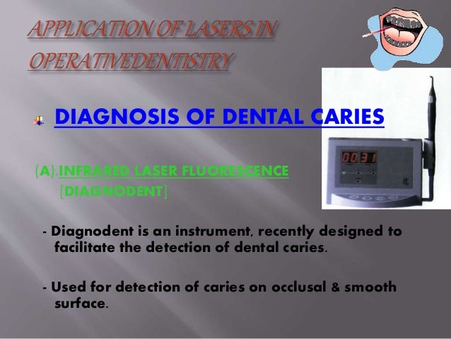 Lasers Used In Operative Dentistry