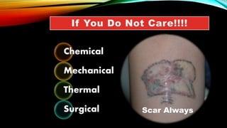 Chemical
Mechanical
Thermal
Surgical Scar Always
 
