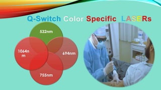 532nm
694nm
755nm
1064n
m
 
