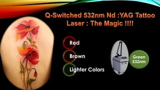 Green
532nm
Red
Brown
Lighter Colors
 