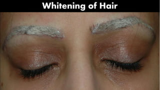 Whitening of Hair
 