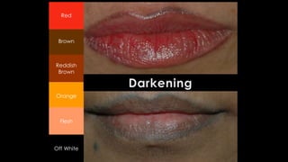 Brown
Red
Orange
Flesh
Off White
Reddish
Brown
 