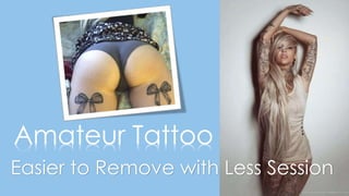 Amateur Tattoo
Easier to Remove with Less Session
 