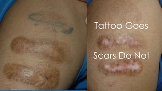 Scars Do Not
Tattoo Goes
 