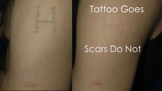 Scars Do Not
Tattoo Goes
 