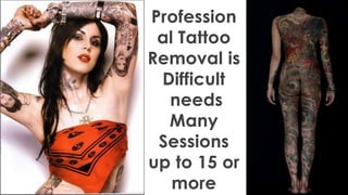 Profession
al Tattoo
Removal is
Difficult
needs
Many
Sessions
up to 15 or
more
 